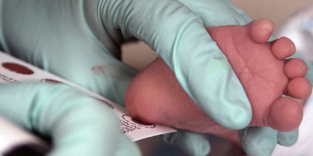 Jak wygląda badanie przesiewowe w kierunku mukowiscydozy u noworodków w Polsce